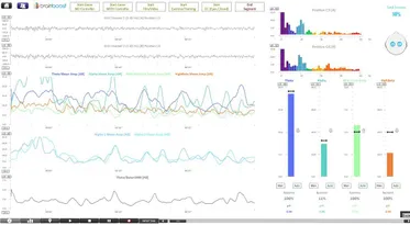 EEG-Aufnahme in der Neurofeedback-Software