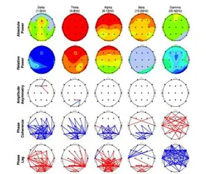 Neurofeedback Munich Depression