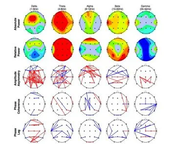 Neurofeedback München Epilepsie