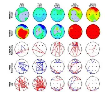 Neurofeedback München ADHS